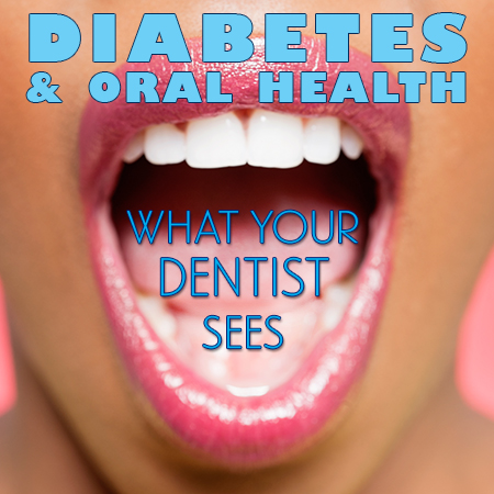 Dental and Diabetes - Advanced Aesthetic Dentistry, Denver